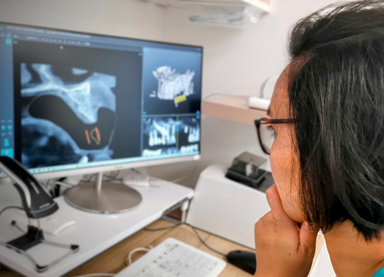Scanner 3d, implant