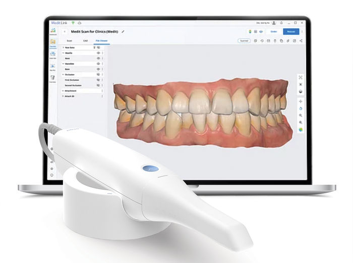 Empreinte numerique scanner intraorale MEDIT